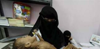 คลังยาของกระทรวงสาธารณสุขเยเมนขาดแคลนเวชภัณฑ์ยาอย่างหนัก