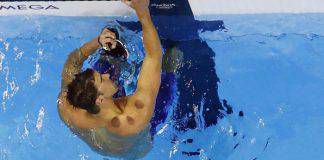 ไขความลับ “จุดสีแดง”บนร่างกายของนักกีฬาโอลิมปิกในริโอ 2016