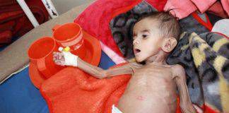 600 วันแห่งการถูกปิดล้อมและการฆ่าล้างเผ่าพันธุ์ในเยเมน