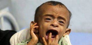 สถานการณ์ความหายนะในเยเมน จากรายงานของกองทุนช่วยเหลือเด็ก